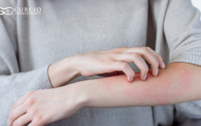 Eczema Skin Care Tips for Healthier Skin in Nashville, TN