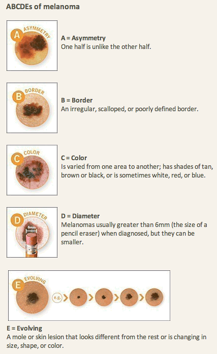 Skin cancer benign and malignant - Hpv virus medikamente