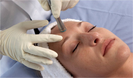 DermaSweep® treatment DermaSweep® treatment