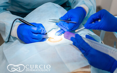 Mohs Surgery Recovery: Tips for Healing Faster and Reducing Scarring