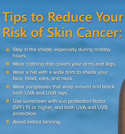 skin cancer prevention tips